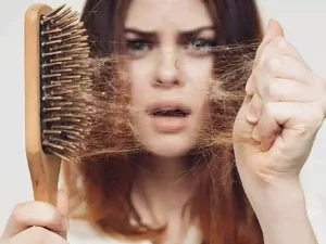 علت و درمان ریزش مو در طب سنتی از نگاه متخصصان